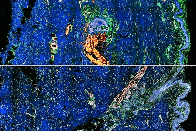 Micrographs showing delivery via the skin